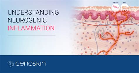 Understanding neurogenic inflammation - Genoskin