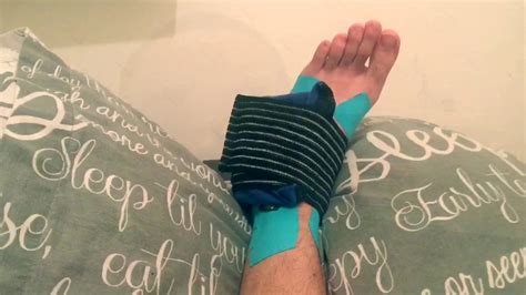 How To Treat Ankle Sprain Youtube