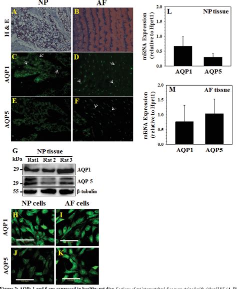 Figure From Aquaporin And Expression Decreases During Human