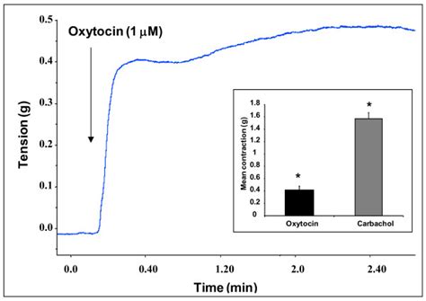 Representative Trace Showing The Contractile Response Induced By Download Scientific Diagram