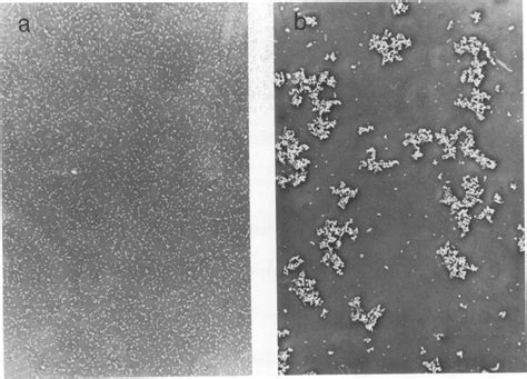 Phase Contrast Micrograph Of Ont After Incubation At C For H In