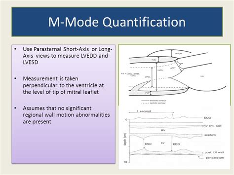 EVALUATION OF SYSTOLIC FUNCTION OF LEFT VENTRICLE BY ECHOCARDIOGRAPHY