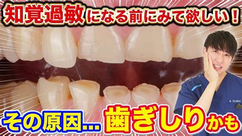 歯ぎしり・食いしばりの原因と治す方法を歯医者が徹底解説します！【知覚過敏マウスピースボトックス】 Youtube