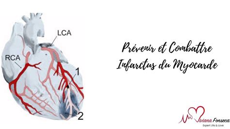 Pr Venir Combattre L Infarctus Du Myocarde Et Ath Roscl Rose Youtube