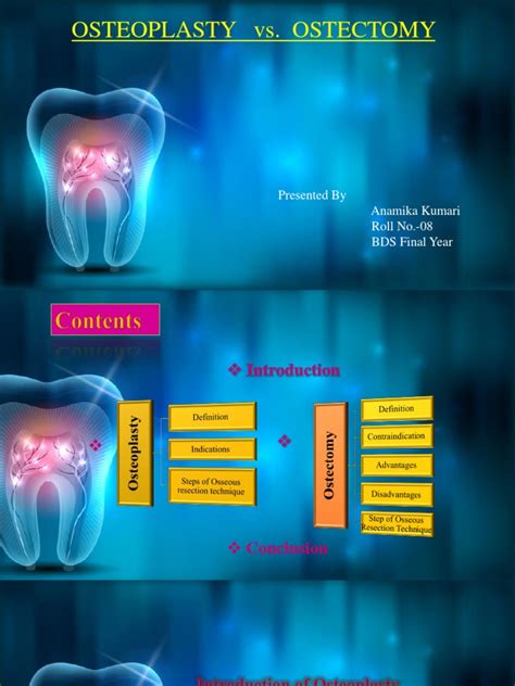 Osteoplasty Vs Ostectomy | PDF