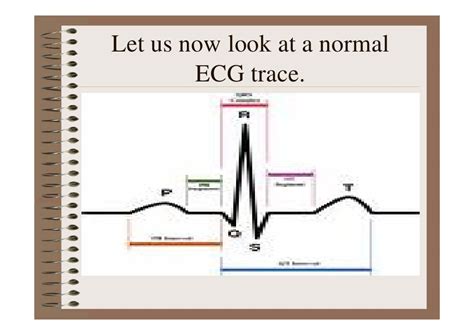 Cardiac Ecg Interpretation