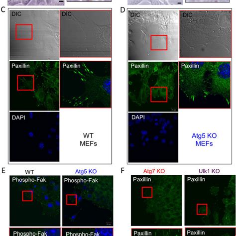 Loss Of Atg Facilitates Amoeba Like Migration A B Confluent