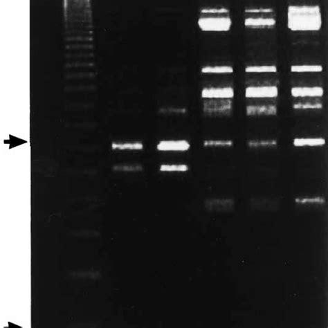 Random Amplification Of Polymorphic Dna Rapd Profiles Of Candida