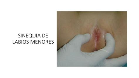 Sinequia De Labios Mary Mednotes UDocz