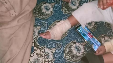 Muhammad KY Paon Par Fracture Ho Gaya YouTube