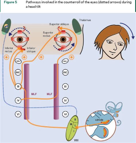 [PDF] Pearls & Oy-sters: The medial longitudinal fasciculus in ocular motor physiology ...