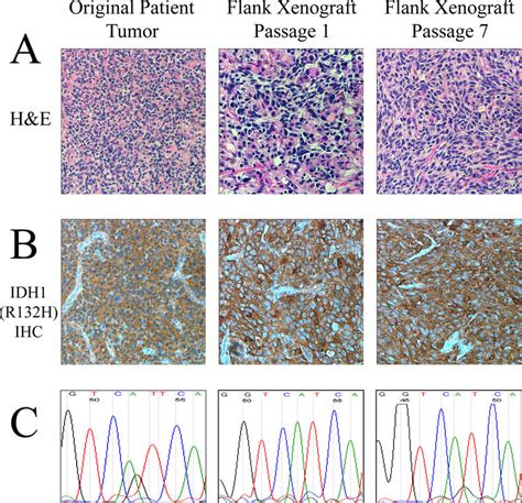 Characteristic Histological And Genetic Features Of The Idh R H