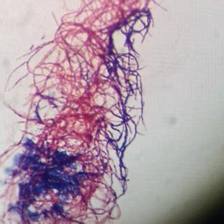 Positive Gram-stain (Micrococcus luteus) (Image: Tim Sandle) | Download ...