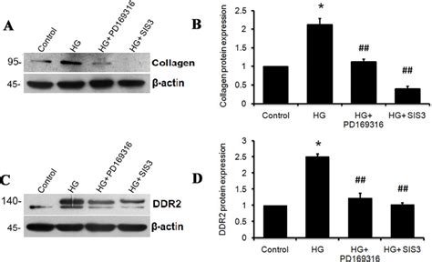 SMAD2 3 Inhibition Attenuates HG Induced DDR2 And Collagen Expression