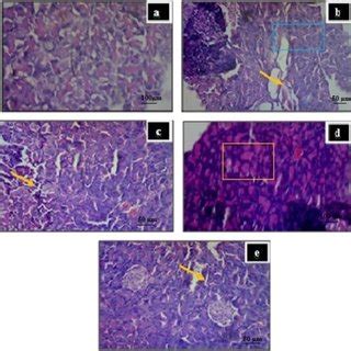 Histological Changes Of Rat Pancreas Of Islets Of Langerhans A Non