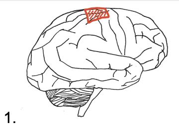 Lesion Game Artery Review Flashcards Quizlet