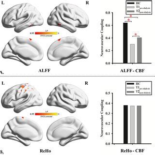 The Postprocessing And Analysis Procedure Of Neurovascular Coupling