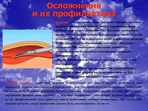 Внутривенные катетеры, алгоритм постановки и ухода. Пути профилактики ...