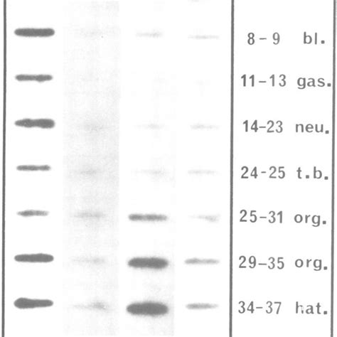 Slot Blot Hybridization Of Total Rna Extracted From X Laevis