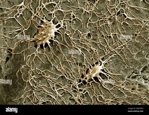 Osteocyte Bone Cells Coloured Scanning Electron Micrograph Sem