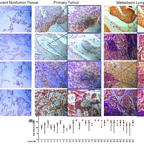 Expression Of Er Via Immunohistochemical Analyses Of Adjacent Nontumor