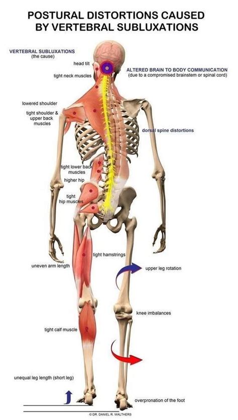 Pin By Body Soul Therapy Alberta C On Scoliosis Massage Therapy