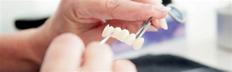 Zahn Gemeinschaftspraxis Veneers Kronen Br Cken