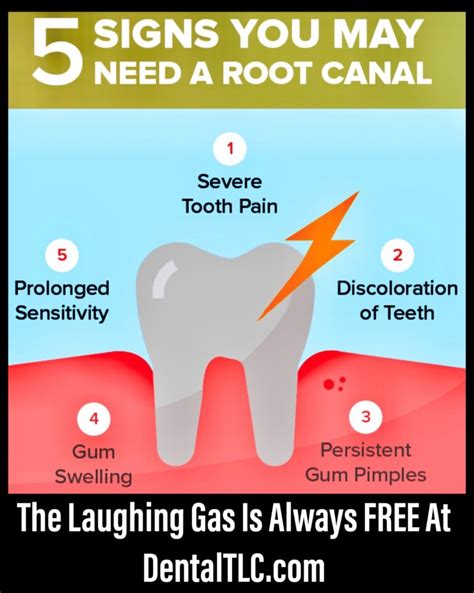 5 Signs You May Need A Root Canal Dental TLC