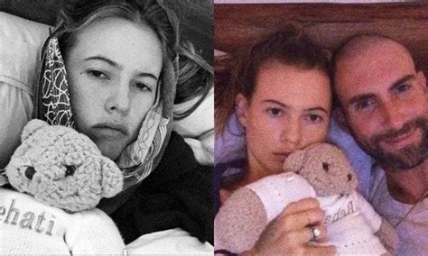 Behati Prinsloo nursed by Adam Levine after wisdom teeth removal