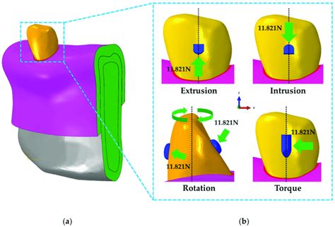 Boundary And Loading Conditions For Orthodontic Treatment Models Download Scientific Diagram