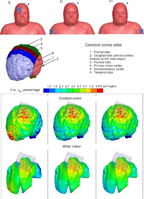 Figure 1 From Comparison Of Cephalic And Extracephalic Montages For