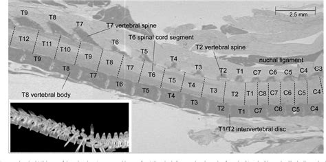 Figure From Vertebral Landmarks For The Identification Of Spinal Cord