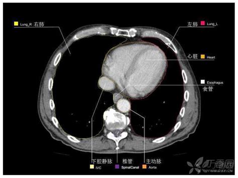 Ct 读片基础入门 丁香园