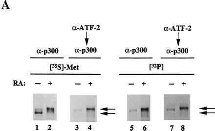 P And Atf Are Components Of The Drf Complex Which Regulates