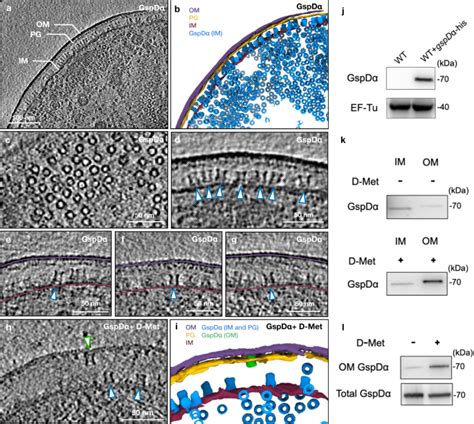 Membrane Translocation Process Revealed By In Situ Structures Of Type