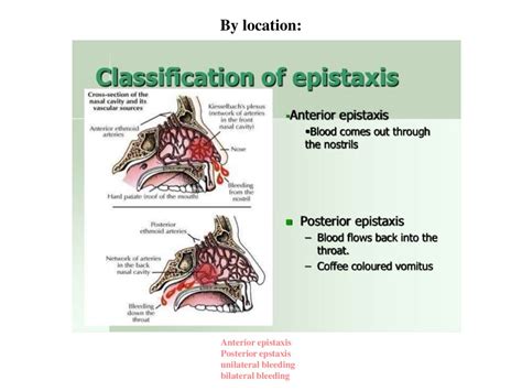 Epistaxis Etiology Pathogenesis Clinic Diagnosis Differential Diagnosis Emergency Care