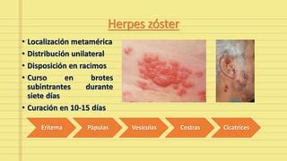 Herpes zóster diseminado PPT Descarga Gratuita