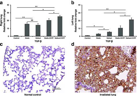 Tissue expression of TGF β a Right lung samples demonstrated higher