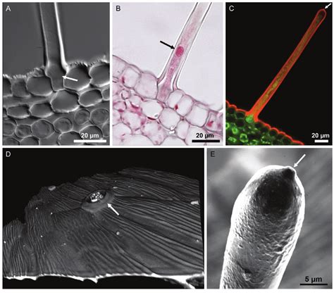 Morphology Of Glandular Trichomes Of E Hirsutum A B C Transversal