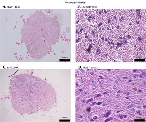 Histology Of The Spinal Cords Of Mice In The Neuropathy Model Of Download Scientific Diagram