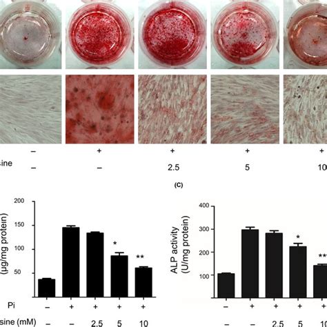 Carnosine Attenuation Of Vascular Smooth Muscle Cell Vsmc