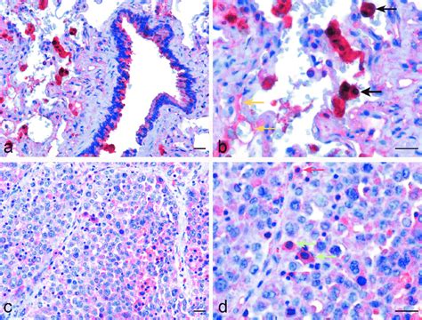 Immunohistochemistry Evaluation Of Properdin In Healthy Lung And Lung