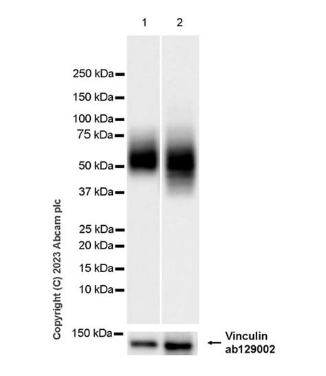 Glucose Transporter Glut3glut14重组抗体 Epr28481 54 Glucose Transporter