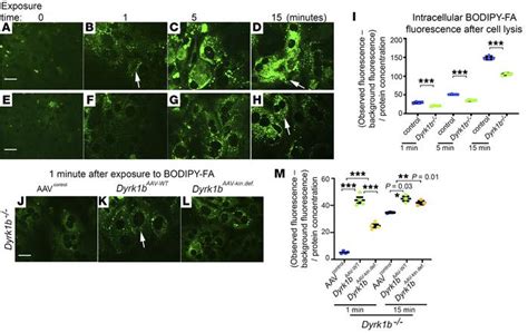 Jci Dyrk1b Promotes Hepatic Lipogenesis By Bypassing Canonical