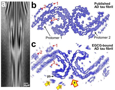 Transient Cryoem Structure Of Ad Brain Derived Tau Fibril Bound To