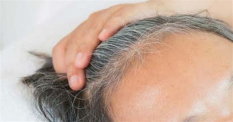 Como Cubrir Las Canas Con Este Remedio Casero Tuve Que Verlo