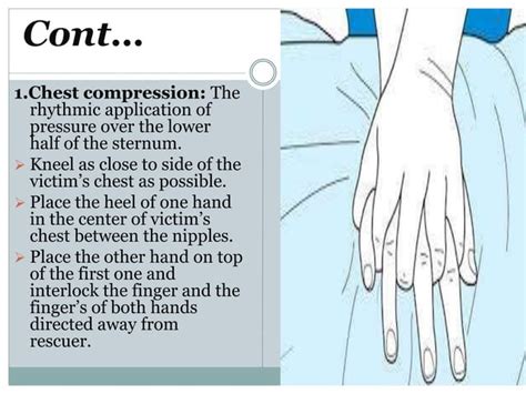 Cardiopulmonary resuscitation(cpr) | PPT