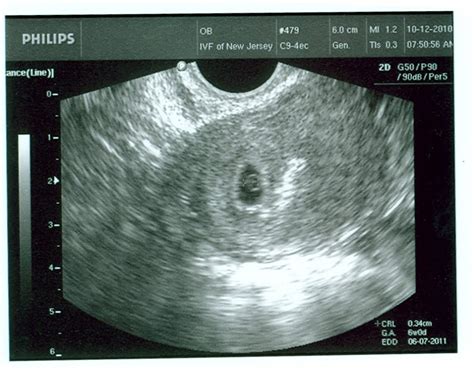 the world as i know it: 5w5d - One is NOT the loneliest number