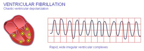 19 The Basis Of Ecg Diagnosis