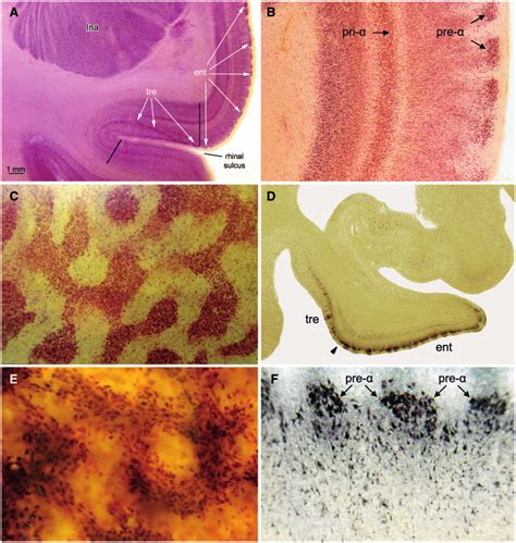 The transentorhinal and entorhinal cortex. (A) Found only in higher ...